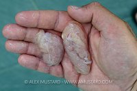 Lionfish Egg Sacs. Cayman Islands.