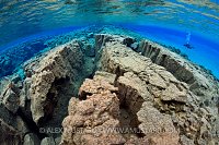 Diver with fractures. Iceland.