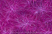 Pink Sponge Detail, Indonesia