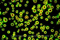 Fluorescent Jewel Anemones. UK.